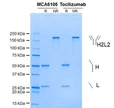 anti tocilizumab elisa kit|IL6R Antibody (rhPM.